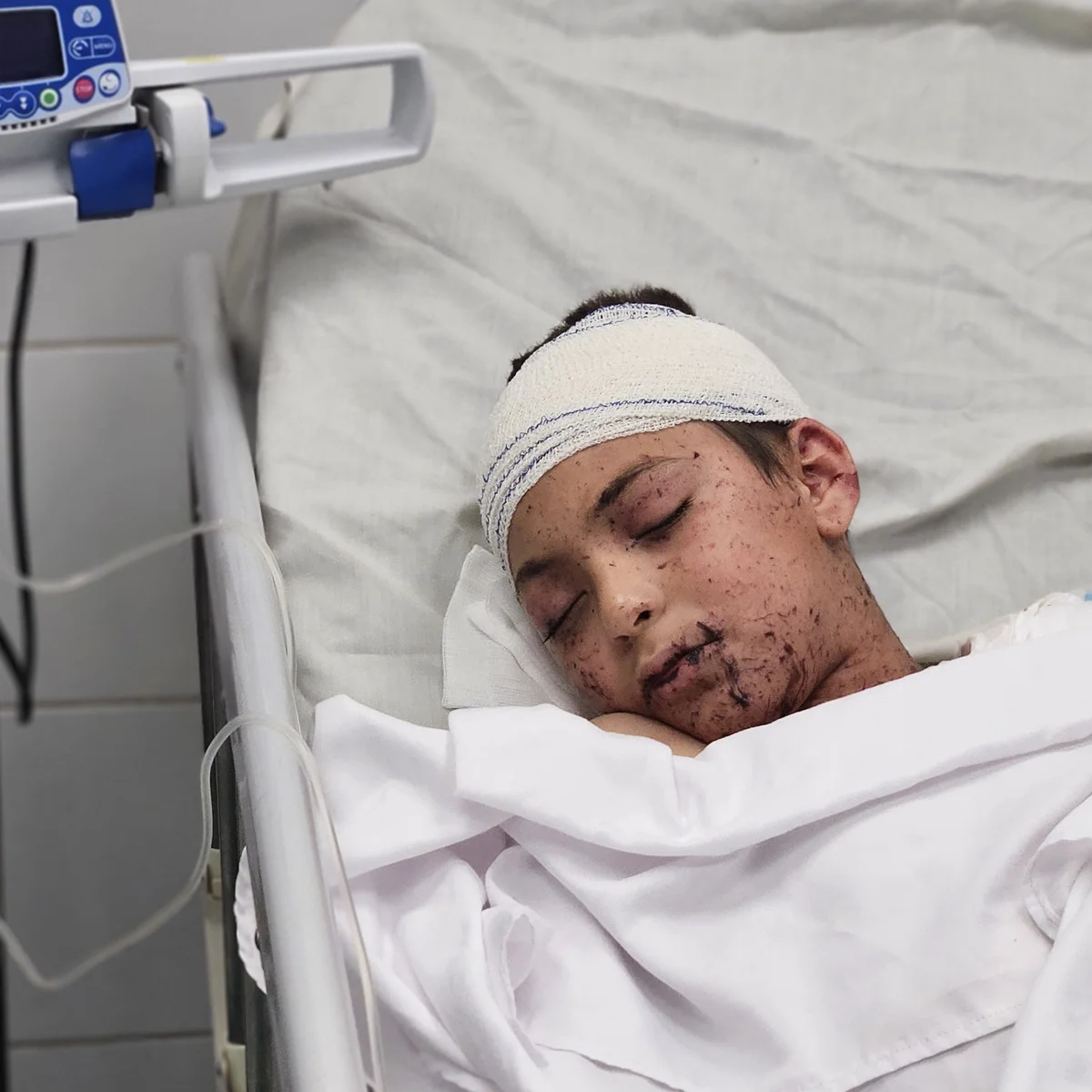 Israeli Airstrike Devastates a Doctor’s Family, One Survivor of 10 Children: Father Critical